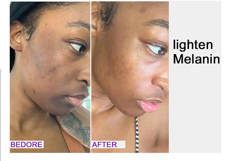 AILKE Glutathione Whitening Skincare Set – Hydrating & Even Skin Tone Solution ✨