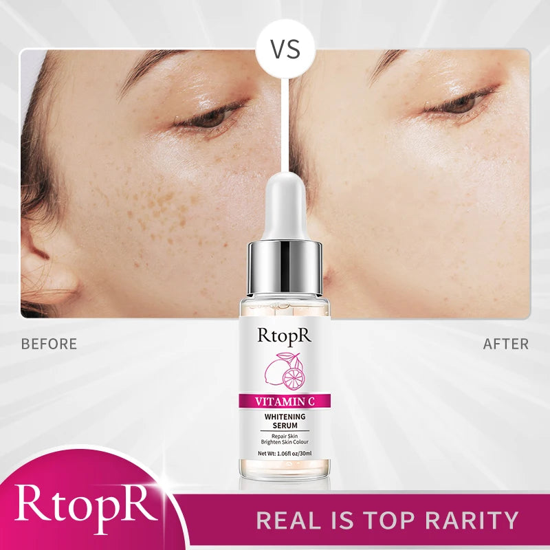 ✨ RtopR Vitamin C Whitening Serum – Brighten & Hydrate for a Radiant Glow ✨