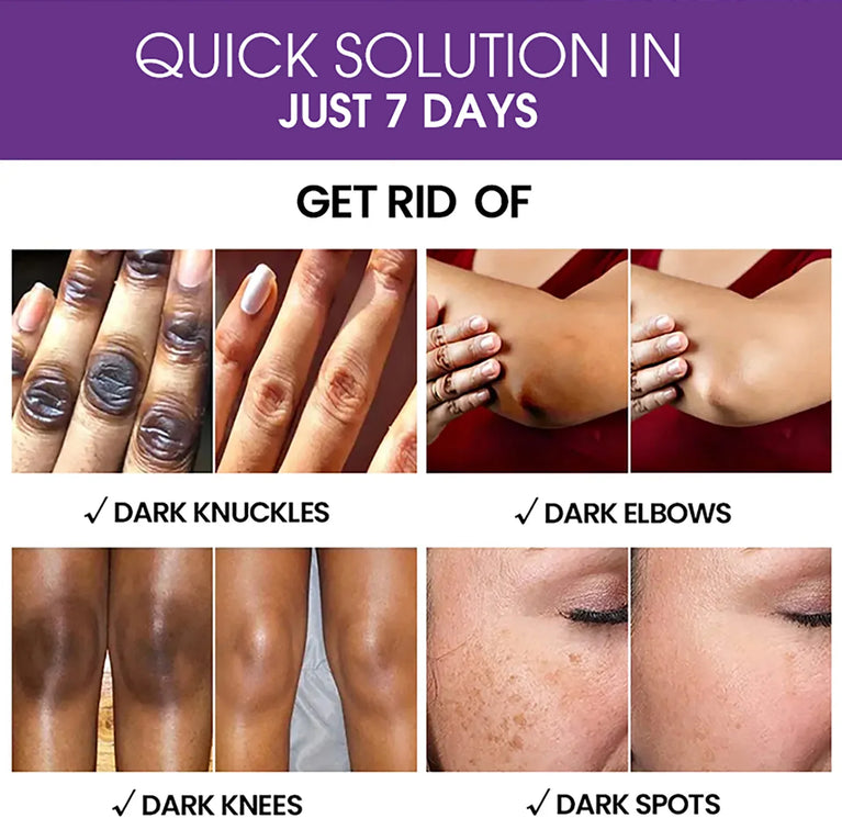 AILKE Glutathione Whitening Skincare Set – Hydrating & Even Skin Tone Solution ✨