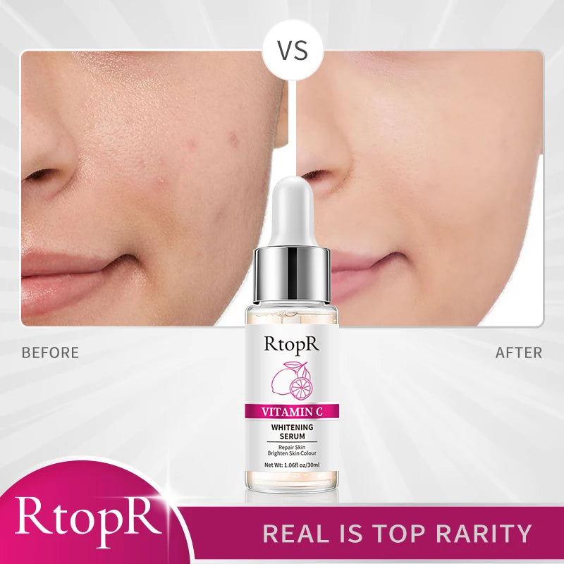 ✨ RtopR Vitamin C Whitening Serum – Brighten & Hydrate for a Radiant Glow ✨