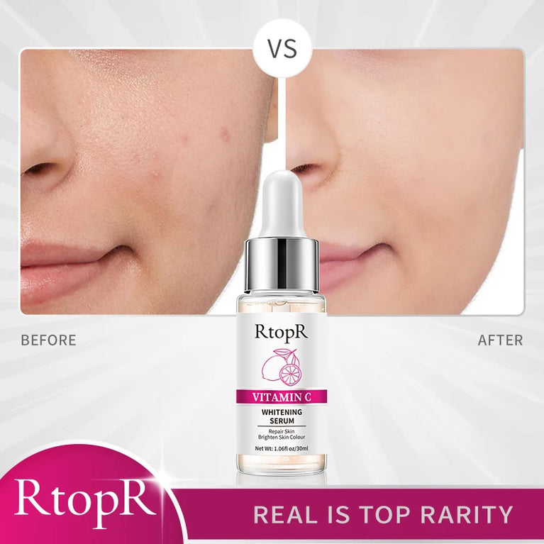 ✨ RtopR Vitamin C Whitening Serum – Brighten & Hydrate for a Radiant Glow ✨