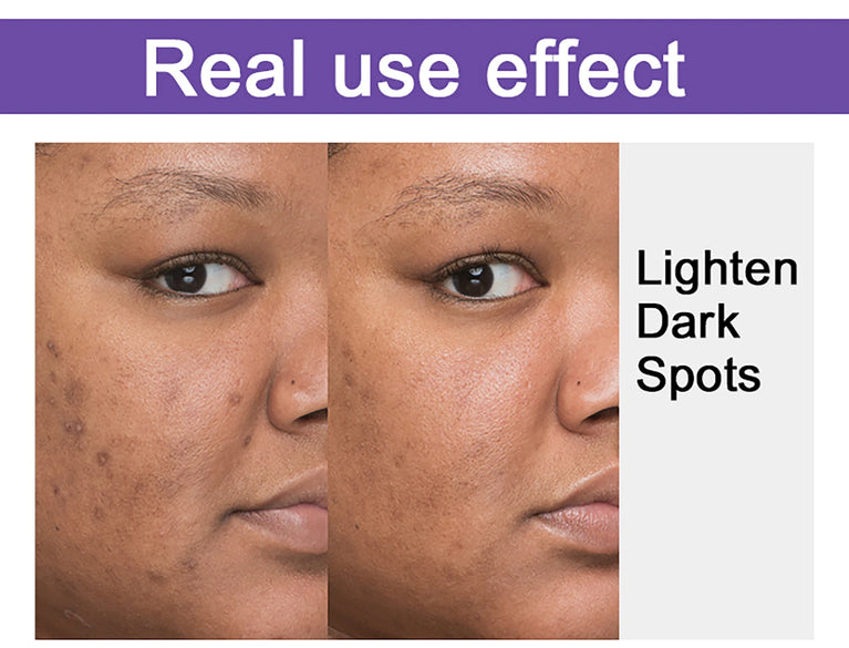 AILKE Glutathione Whitening Skincare Set – Hydrating & Even Skin Tone Solution ✨