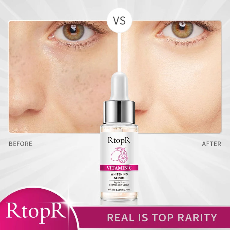 ✨ RtopR Vitamin C Whitening Serum – Brighten & Hydrate for a Radiant Glow ✨