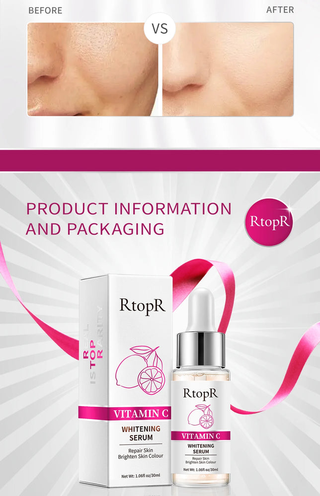 ✨ RtopR Vitamin C Whitening Serum – Brighten & Hydrate for a Radiant Glow ✨