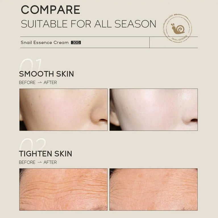 ๐ฟ LAIKOU -Snail Face Cream โ Anti-Aging, Wrinkle Removal & Deep Hydration for Radiant Skin (30g) ๐ฟ