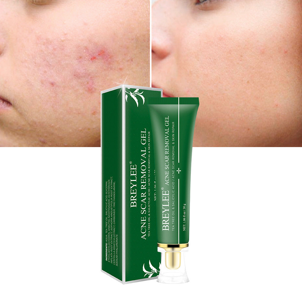 BREYLEE - Tea Tree Acne Scar Removal Gel – Fades Scars & Clears Skin