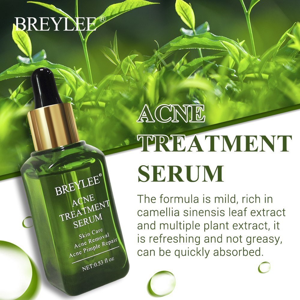 BREYLEE Acne Treatment Serum – Clears Pimples, Scars & Brightens Skin