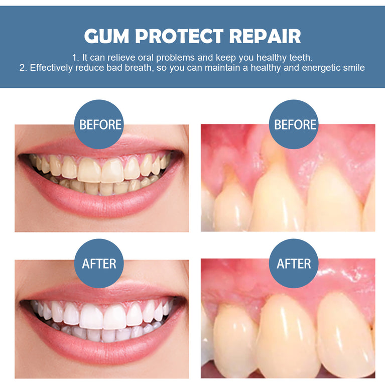 EELHOE Gum Repair – Advanced Oral Care for Healthy Gums & Clean Teeth