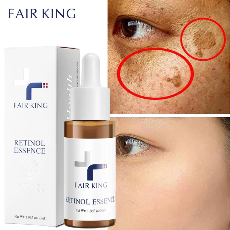 🌟 Retinol Anti-Aging Serum – Smooth Wrinkles, Brighten Skin & Minimize Pores 🌟